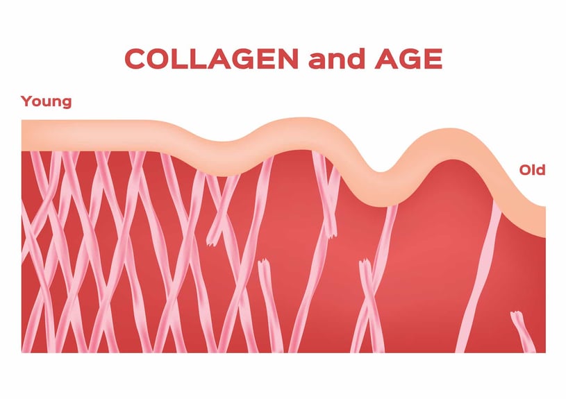 Collagen As We Age: Role, Signs, Procedures, Products, and Preventative Measures