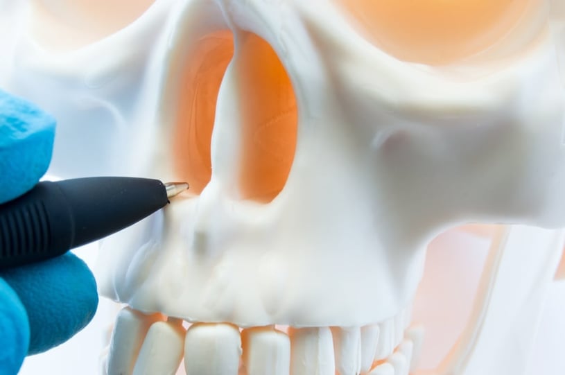 Deviated Septum: Symptoms, Causes, and Rhinoplasty (Nose Job)