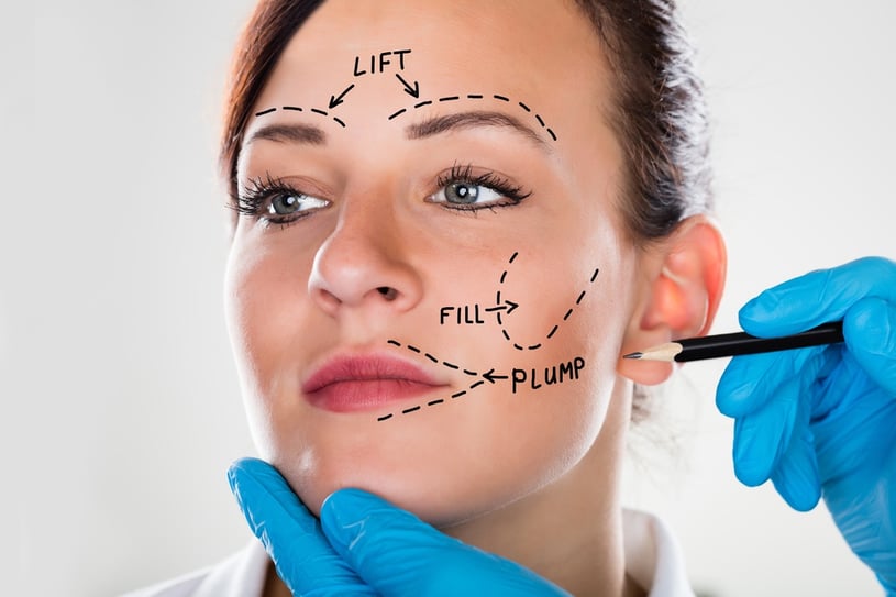 What is a Facelift Procedure? (Benefits, Risks, and Recovery Time)