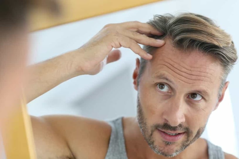 NeoGraft Hair Transplant in Houston: Procedure, Recovery, and Results