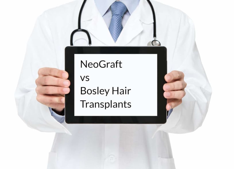 Hair Transplant in Houston: Neograft vs Bosley