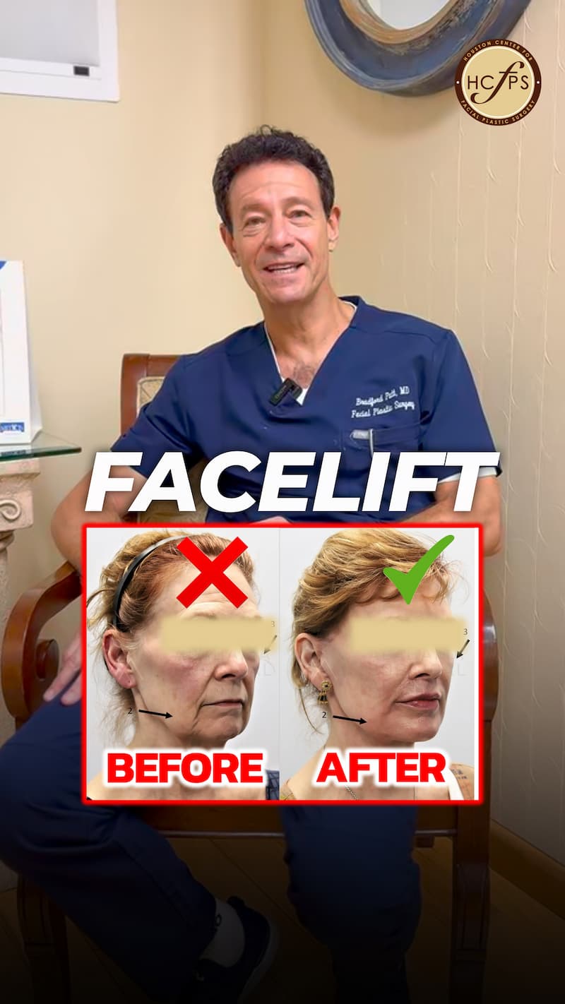 Personalized Facelift Consultations: Options for a Youthful Appearance