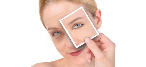Things to Know About Blepharoplasty