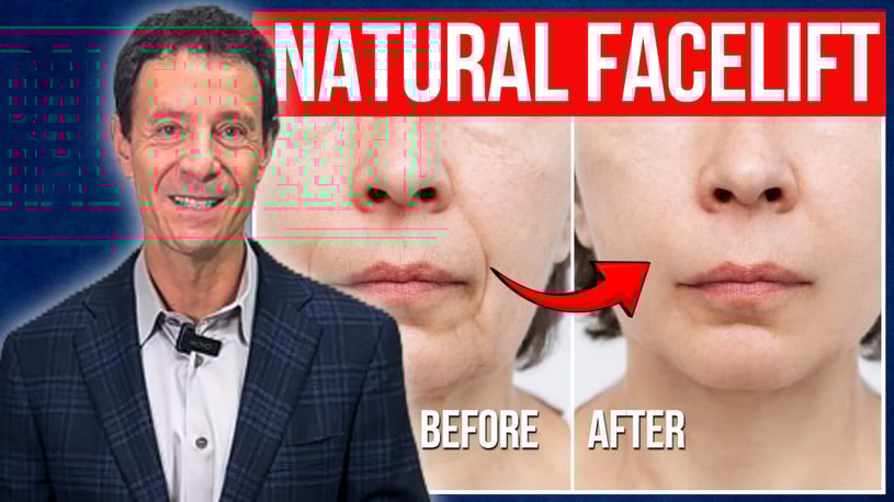 BEST FACELIFT FOR MINIMAL SCARRING AND MAXIMUM RESULTS: THE NATURAL LIFT EXPLAINED